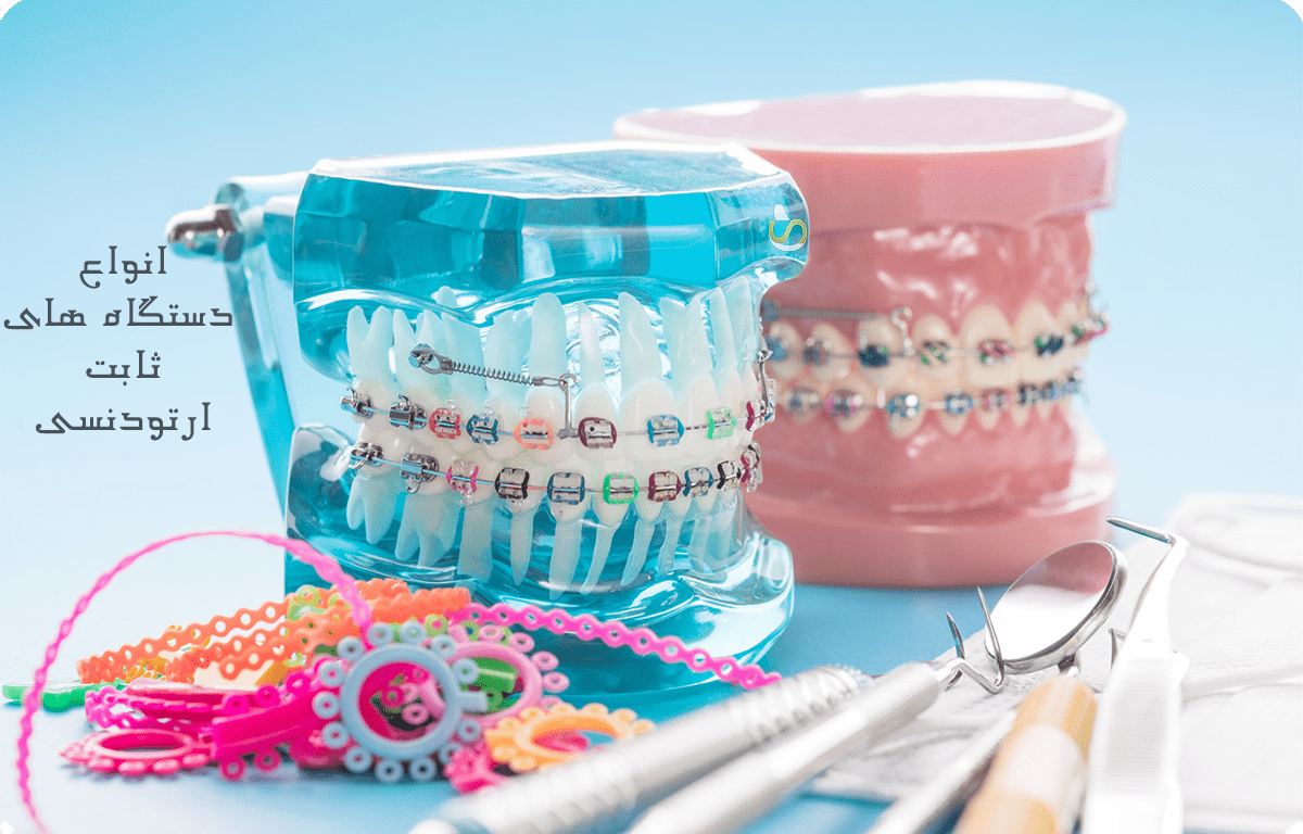 دو مدل ماکت دندان ارتودنسی رنگی