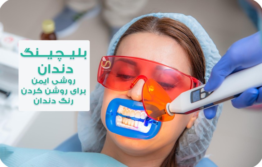 روشن کردن رنگ دندان یک خانم با روش بلیچینگ 