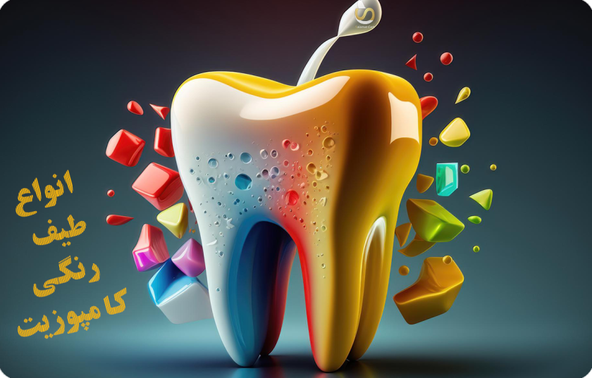 انواع طیف رنگی کامپوزیت دندان با یک تصویر گرافیکی از دندان