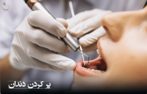 نشان دادن ترمیم دندان توسط دندانپزشک