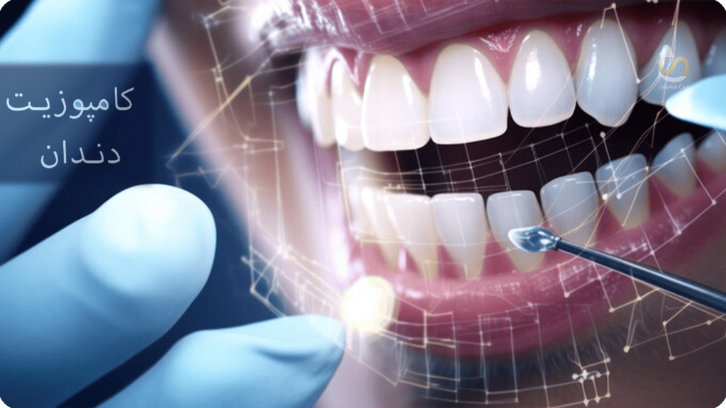 کامپوزیت دندان با شرایط اقساط سلامت کارت