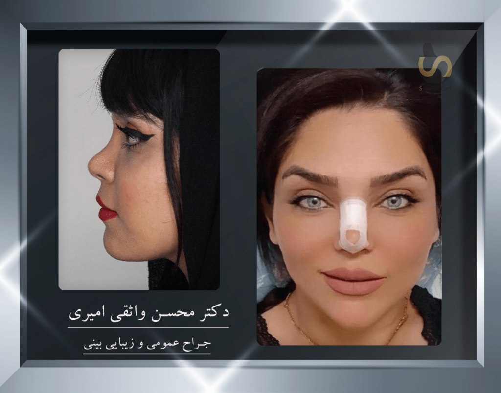 دکتر محسن واثقی امیری - جراح پلاستیک- سلامت کارت- 