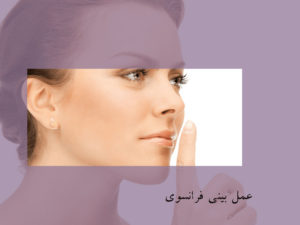 عمل بینی فرانسوی، مدل عمل قلمی- سلامت کارت-