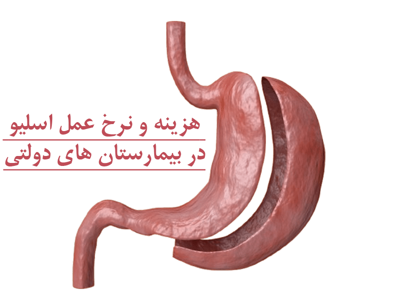 هزینه عمل اسلیو معده در بیمارستان های دولتی-سلامت کارت