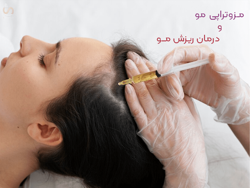مزوتراپی موی و درمان ریزش مو- سلامت کارت