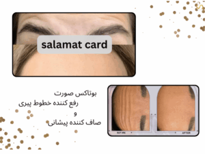 تصویر از صورت دو خانم جوان است که تزریق بوتاکس انجام داده اند و پیشانی شان صاف شده است، سلامت کارت
