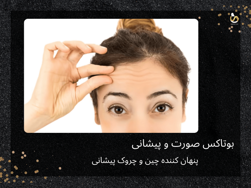 تصویر از دختر جوانی است که پوست پیشانی اش را با دو انگشت گرفته و دارد خطوط آن را نشان می دهد. بوتاکس صورت درمان کننده این خطوط پیشانی به صورت موقت است.