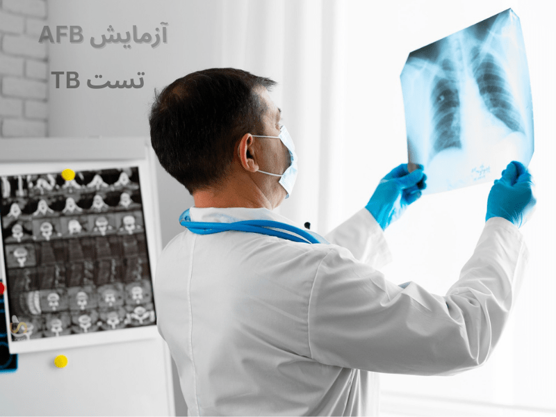 تصویر از پزشکی است که درحال دیدن تصویر ریه فردی است که ریه اش دچار سل شده است.