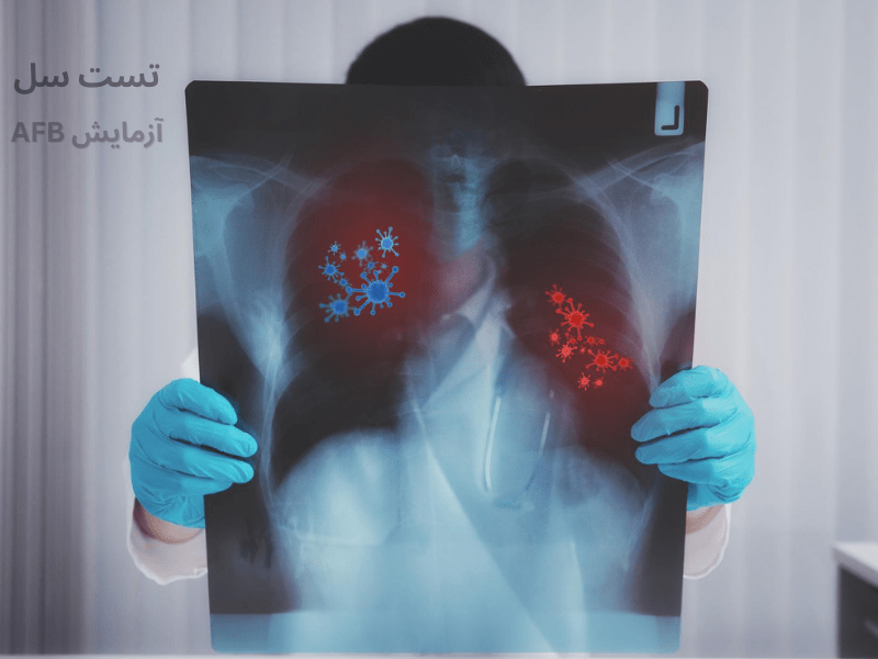 تصویر عکس برداری از قفسه سینه AFB- سلامت کارت