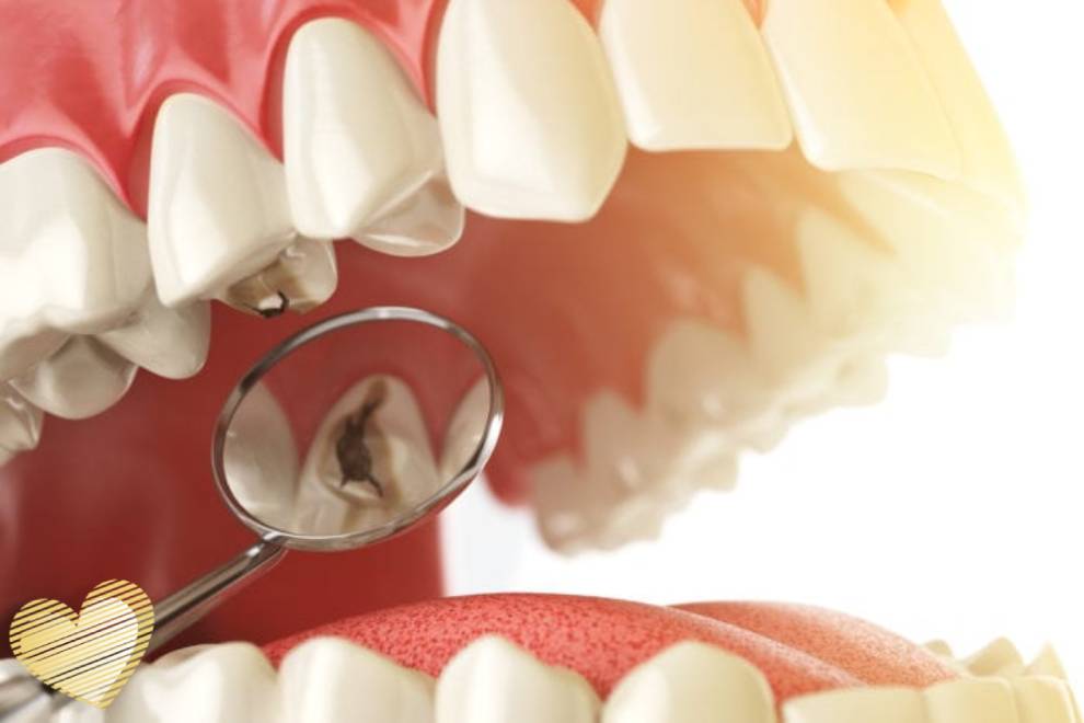 پوسیدگی دندان و روش های درمان آن