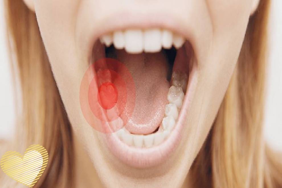 درمان دندان درد با روش های خانگی