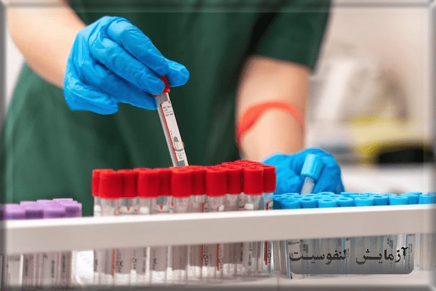 آزمایش تفسیر لنفوسیت خون و مقدار نرمال lymphocyte در برگه آزمایش- سلامت کارت